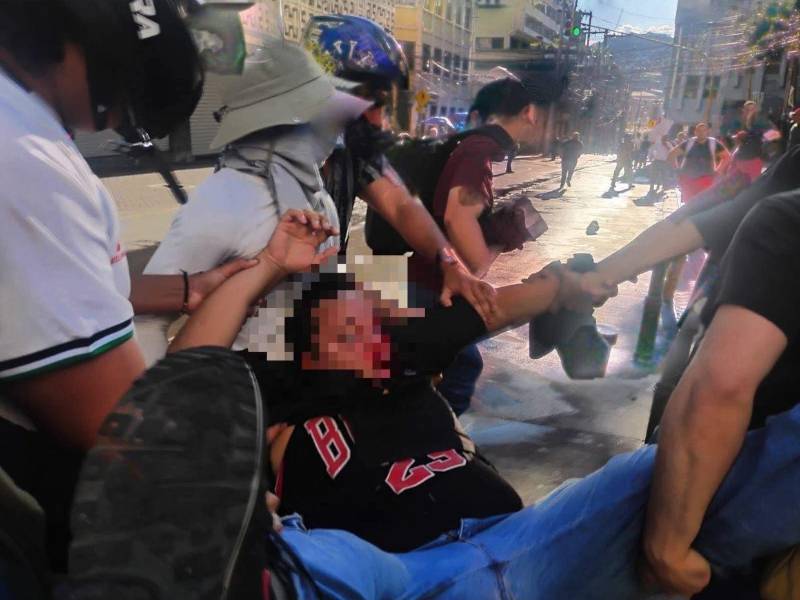 Un estudiante perdió un ojo tras protestas en los bajos del CN.