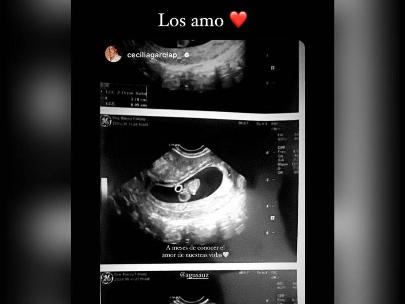 Agustín Auzmendi anuncia que se convertirá en padre junto a su novia Cecilia García