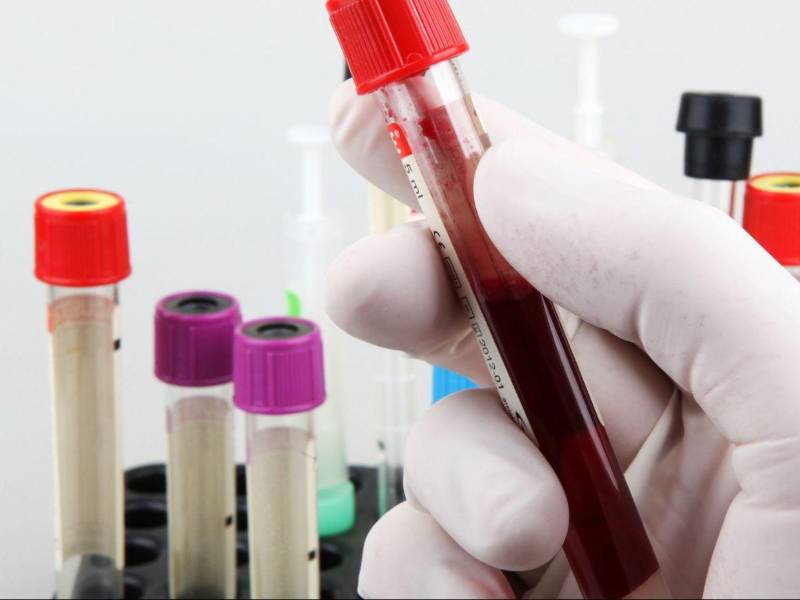 El único laboratorio autorizado para tomar y procesar muestras para detectar el virus del sarampión es el Laboratorio Nacional de Virología.