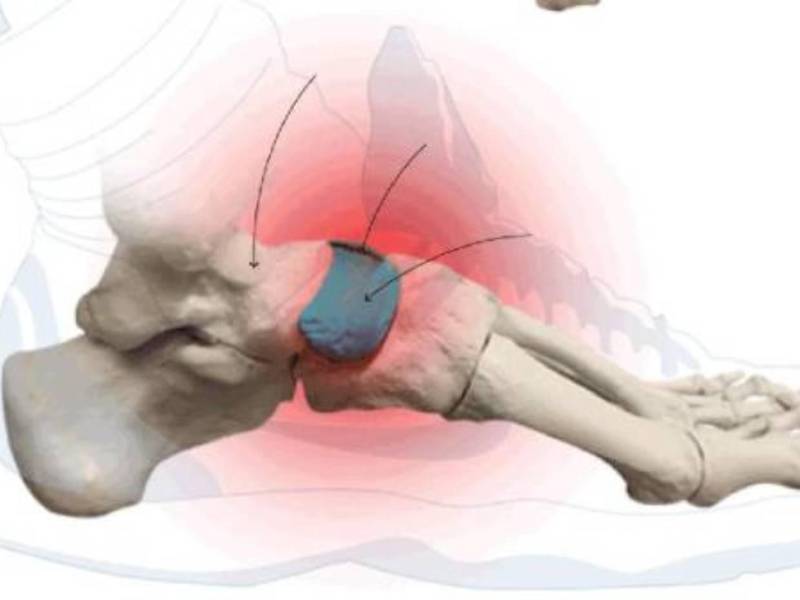 Honduras pierde a otra de sus figuras para partidos de la Eliminatoria Mundialista de Concacaf
