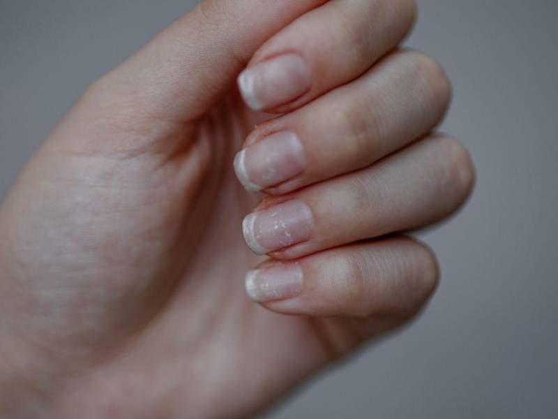 El calcio puede ofrecer beneficios visibles en el corto plazo, pero su impacto real dependerá del producto, la constancia en su uso y el enfoque general con el que se cuide la salud de las uñas.