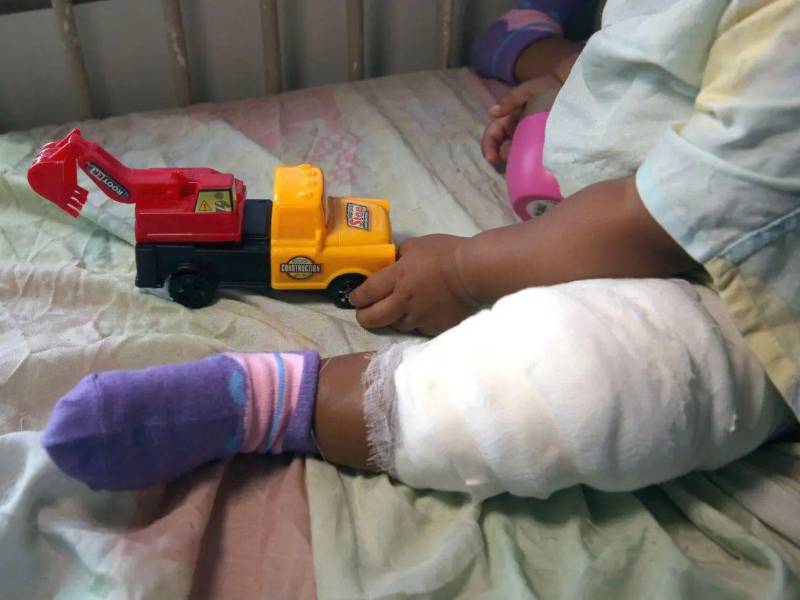 En lo que va del 2025, el Centro Hondureño para el Niño Quemado registra la atención de 450 menores con quemaduras, por diferentes causas.