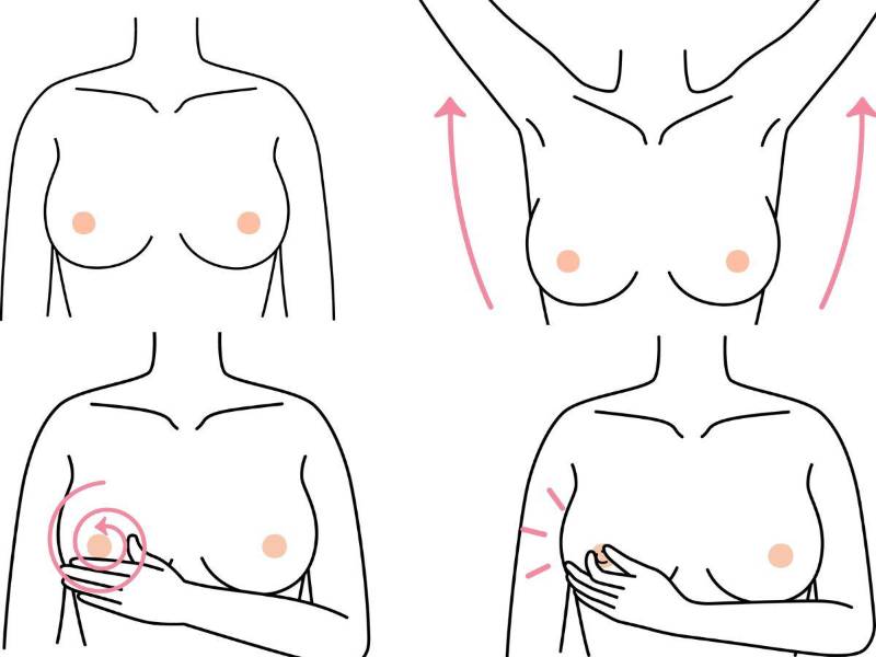 El autoexamen se lo pueden hacer mujeres adolescentes y adultas. Aunque el examen por excelencia para las mujeres mayores de 40 años es la mamografía.