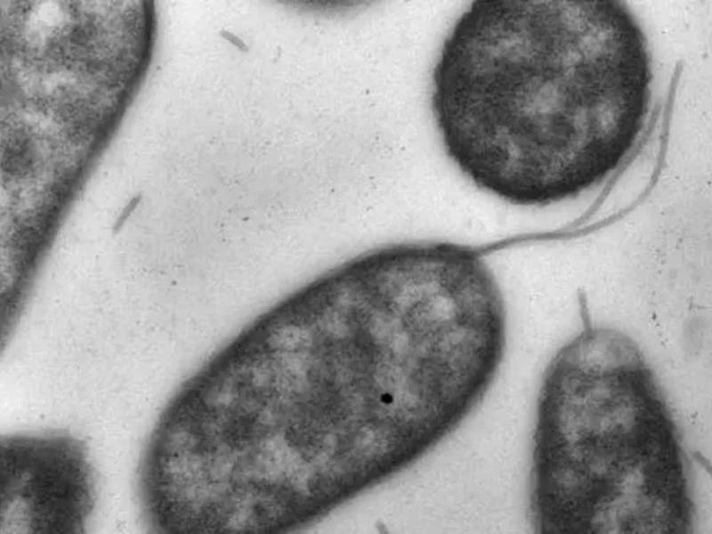 A la bacteria se le conoce como 'come carne' porque la infección en la sangre produce lesiones en la piel con ampollas, además de fiebre, escalofríos y presión baja.
