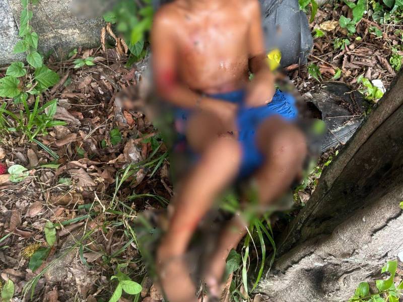 En la foto figura uno de los menores, él sufrió graves mordeduras en una de sus piernas y también se le ven lesiones en sus brazos.