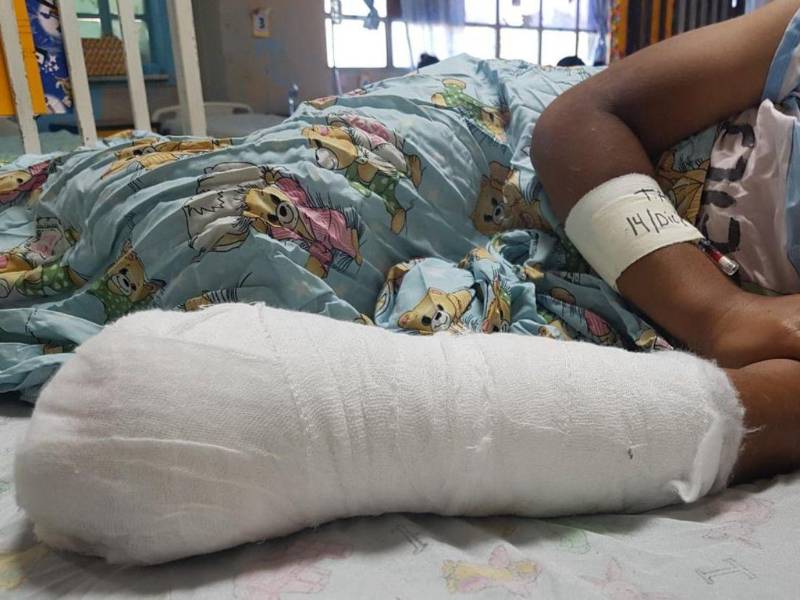 Con las fiestas de fin de año llegan también los menores y adultos que resultan quemados con la explosión de pólvora pese a las prohibiciones en la venta de estos productos en algunas zonas del país. Aquí un recuento de los afectados durante el 31 de diciembre de 2025 y la madrugada del 1 de enero de 2026.