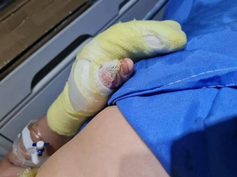 Personal médico del hospital Mario Catarino Rivas atiende a pacientes con quemaduras provocadas por pólvora durante las festividades navideñas.