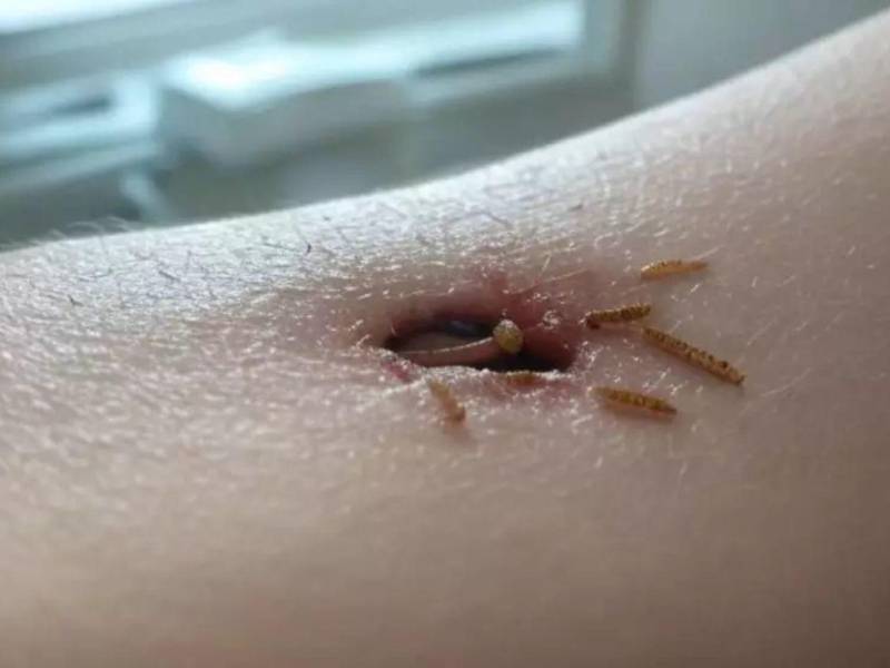 Las autoridades sanitarias aconsejan a la población a cubrirse las heridas abiertas para evitar que la mosca deje sus huevecillos y éstos se conviertan en larvas que se alimentan del tejido vivo.