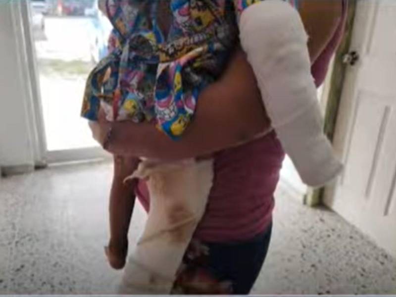 Dipsy Yadira Fernández, madre del menor Liam Adalid Leiva Fernández, denunció públicamente que su entonces compañero de hogar agredió brutalmente a su hijo, causándole quemaduras y fracturas, en un hecho que atribuye a celos.