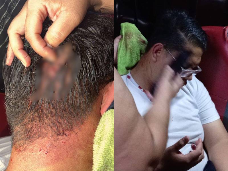 Atacaron con bombas molotov a militantes del Partido Nacional tras salir del escrutinio especial en el CLE.