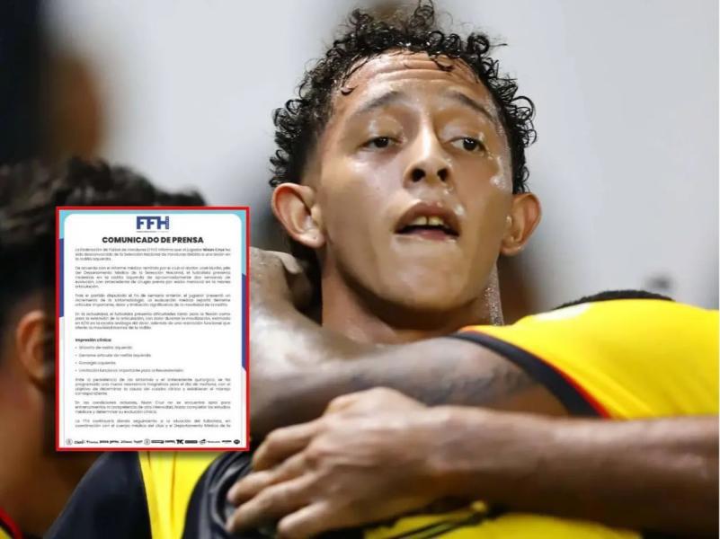¡Dos bajas! El 11 titular con el que dbutaría Honduras en Nations League ante Surinam