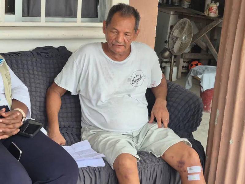 Don César fue atacado el pasado 5 de septiembre y estuvo interno en el Hospital de Atlántida.