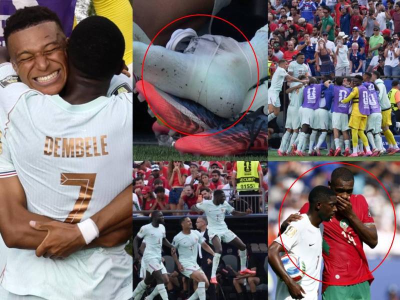 Mbappé salió lesionado y el VAR metido en gran polémica. Las postales que no se vieron en TV del triunfo de Francia sobre Marruecos en el Mundial 2026.