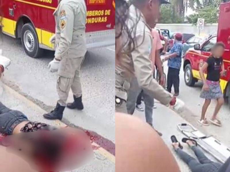 Dos de las mujeres resultaron con heridas más graves al momento del ataque.