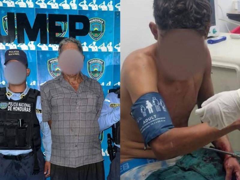 La víctima, cuya identidad no fue revelada, fue trasladada de emergencia al Hospital Mario Catarino Rivas, donde permanece bajo observación médica.