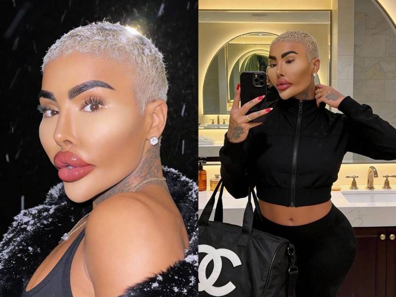 Jordan James Parke, el influencer británico que se hizo famoso por sus exhuberantes labios y su transformación física radical, murió el miércoles 18 de febrero en Londres a los 34 años, según trascendió en las últimas horas.