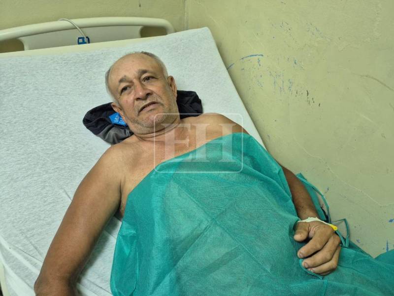 “No se lo deseo a nadie... Es un milagro que estoy vivo”: don José sobrevivió tras caerle un rayo en La Ceiba