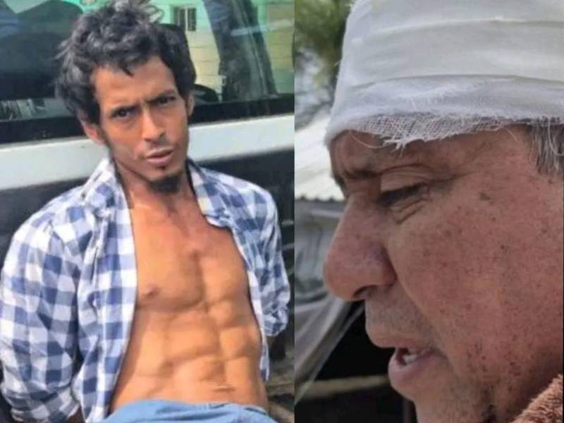 Un padre fue agredido por su hijo en La Ceiba, quien presuntamente le lanzó una taza de café y luego, lo golpeó.