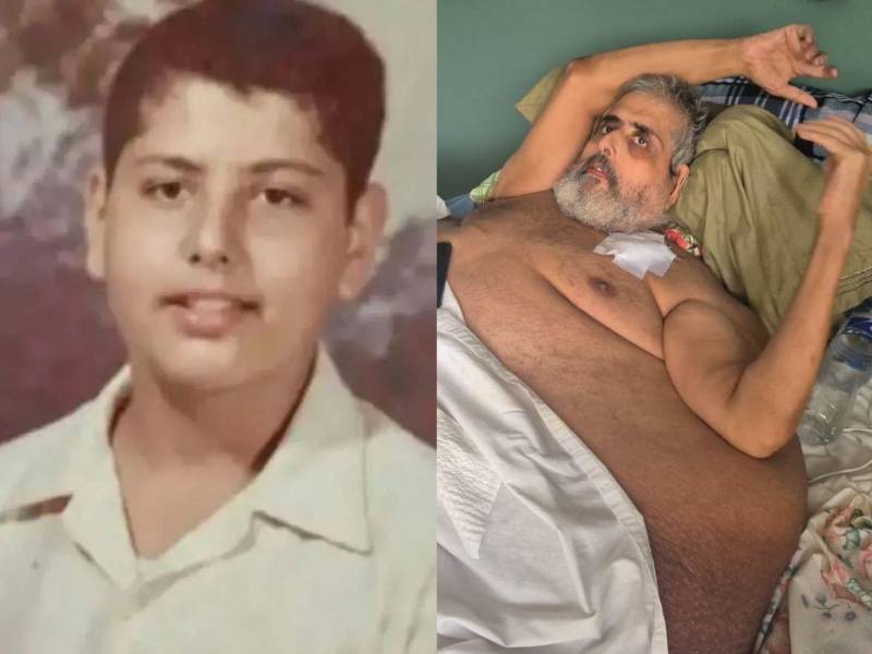 La hermana de Nasser Hilsaca, hondureño que llegó a pesar 630 libras y falleció el 8 de agosto, brindó algunos detalles sobre él y su familia. ¿Eran millonarios? ¿Quedaron con deudas?