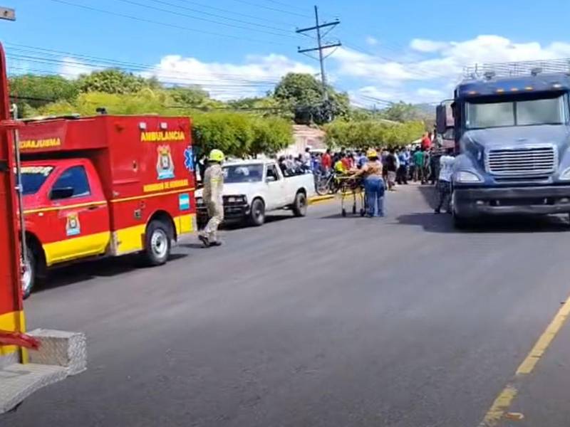 Hasta el momento se desconocen las causas que provocaron el accidente.