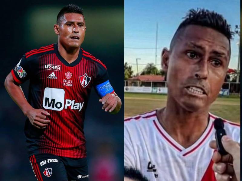 Osvaldo Martínez ha revelado por qué su cambio físico y comenta qué enfermedad sufre luego de haber dejado el fútbol mexicano.