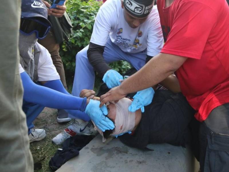 En la protesta que se registró este lunes a inmediaciones del Congreso Nacional el estudiante Axel Medina resultó gravemente herido, al punto que perdió su ojo izquierdo.
