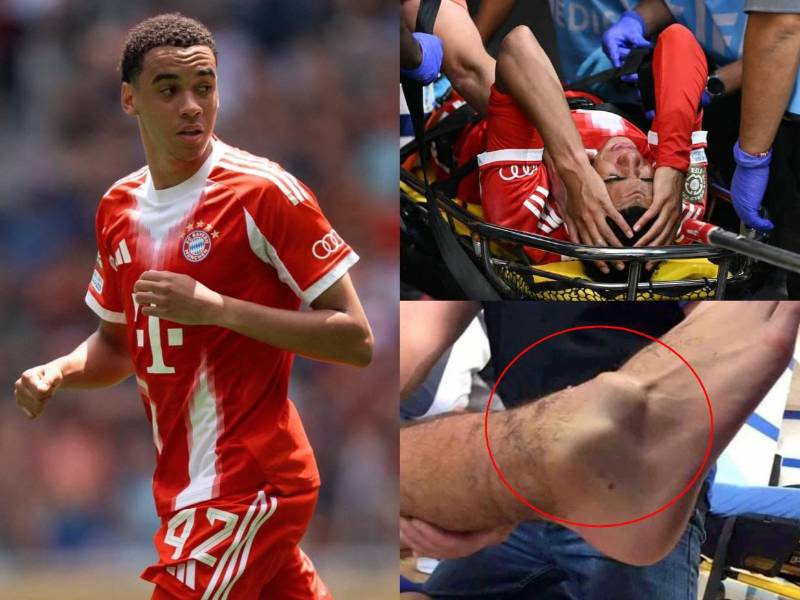 Jamal Musiala, centrocampista del Bayern Múnich, salió lesionado en los cuartos de final del Mundial de Clubes ante el PSG y ya se conoce su diagnóstico oficial. Este tiempo estará de baja.