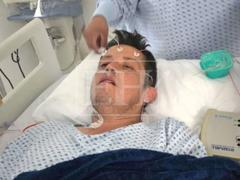 El diputado Octavio Morales Bonilla fue operado con éxito para recibir un corazón artificial en México.