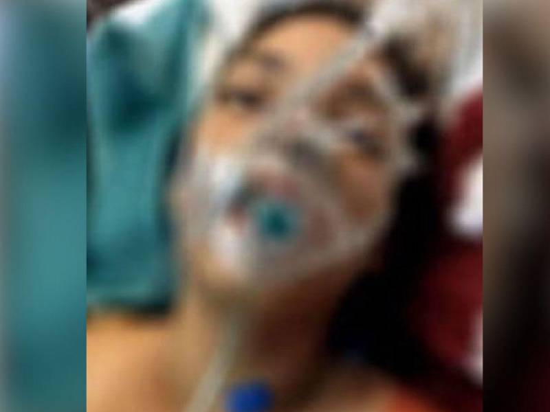 La joven resultó gravemente herida y fue trasladada al Hospital Escuela de Tegucigalpa para recibir atención médica.
