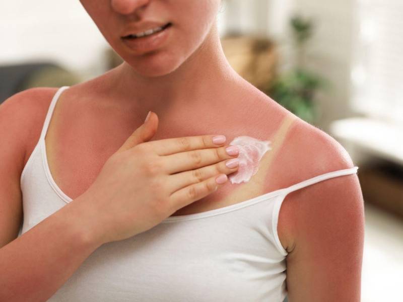 Investigadores de Binghamton demostraron que el calor combinado con la radiación solar debilita las uniones entre células de la capa externa de la piel, facilitando la entrada de bacterias.