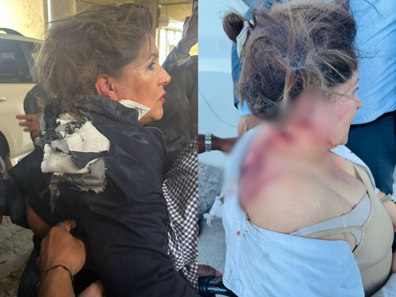 Acostada en una camilla, a la espera de los resultados médicos y de una segunda evaluación, se encuentra la diputada nacionalista Gladis López, quien fue atacada con un artefacto explosivo cuando se disponía a ingresar al Congreso Nacional (CN). Esto dijo sobre su estado de salud: