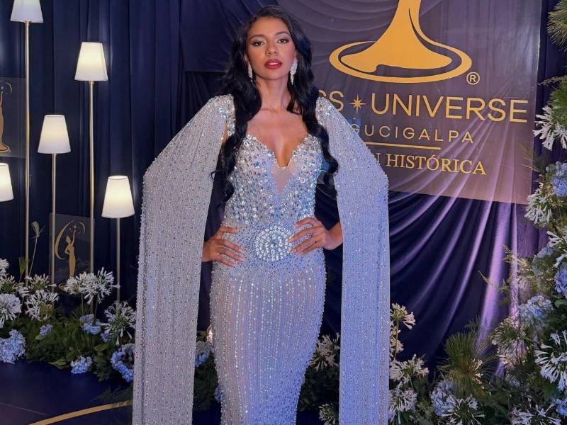 La investigación por la muerte de Wualys Fuentes Aquino, virreina de Miss Universo Tegucigalpa 2026, continúa en manos de Medicina Forense, donde uno de los estudios que podría ser determinante para esclarecer el caso es la histopatología, un examen especializado que permitirá conocer si existía alguna alteración en los tejidos de la joven antes de su fallecimiento.