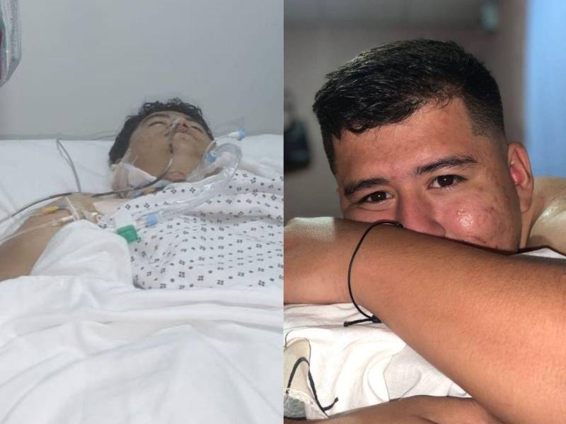 Pese a las operaciones realizadas para salvar su vida, Brayan Fernández falleció la noche del martes en el hospital Mario Catarino Rivas, luego de permanecer varios días hospitalizado.