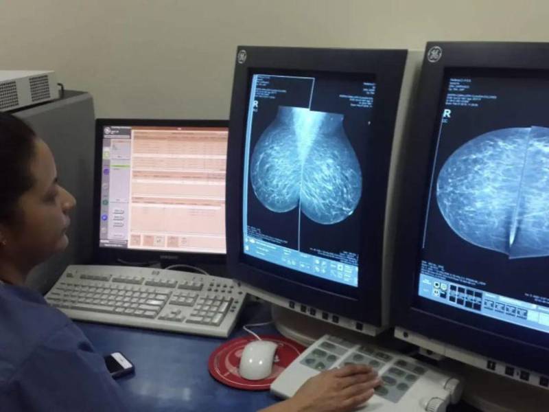 Mediante este estudio, los especialistas pueden identificar cáncer de mama, quistes u otras alteraciones que requieren evaluación médica.