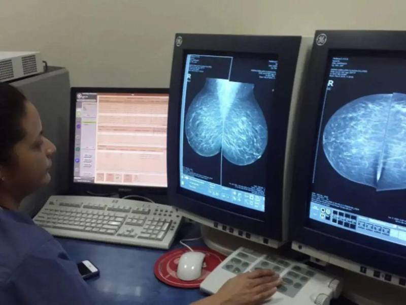 Las mujeres que detecten un bulto, cambios en la forma de las mamas, hundimientos o secreciones deben buscar atención médica para que un profesional evalúe los síntomas y determine los estudios necesarios.