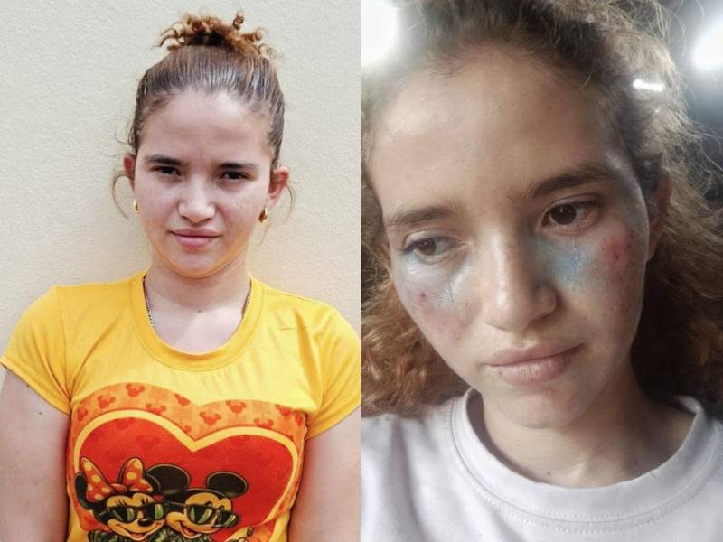 Hondureña fngió su secuestro dos veces y usó imágenes creadas con IA para simular que estaba golpeada