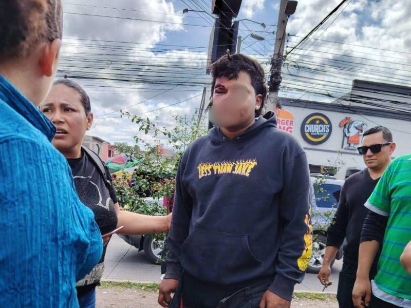 Testigos afirman que el joven conducía a exceso de velocidad.