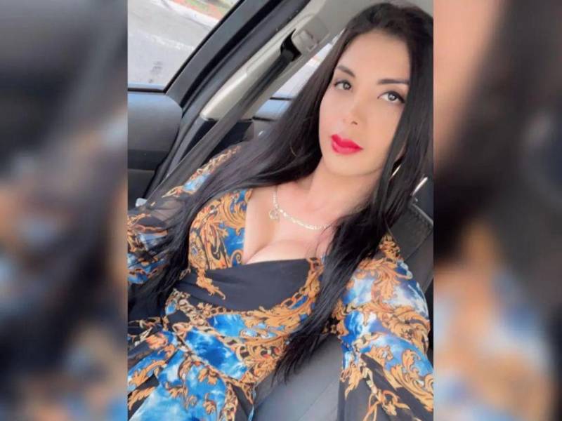 Giseel Aguilar presumía en sus redes la figura femenina que había logrado obtener, debido a múltiples cirugías estéticas que se había realizado en el extranjero.
