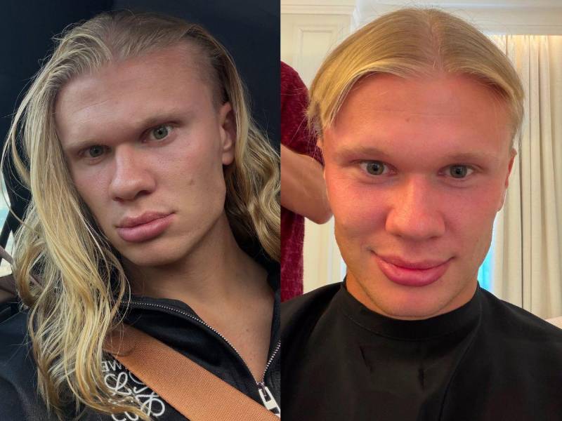 Erling Haaland sorprendió a sus millones de seguidores al mostrar un radical cambio de imagen. ¡Adiós a la icónica cabellera rubia!
