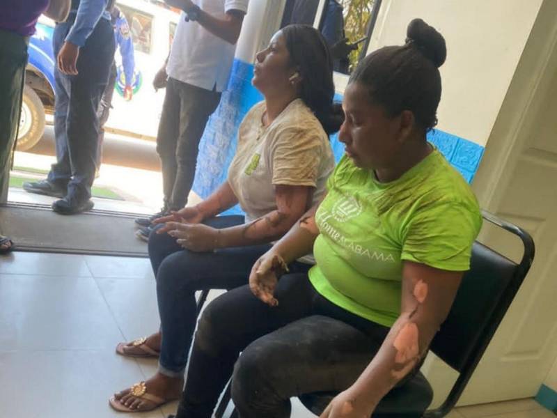 Al menos tres personas resultados con serias quemaduras por el incendio, entre ellas dos mujeres.