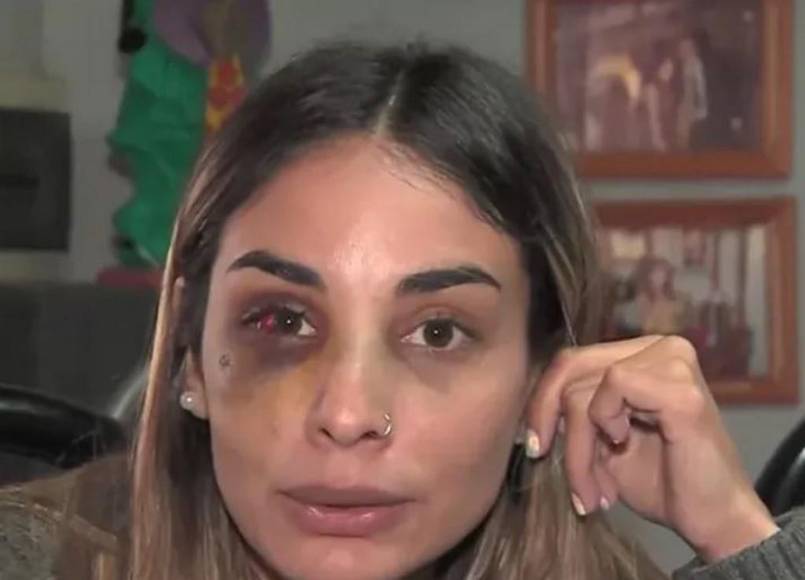 “Por si me mata”: joven envía su ubicación a amiga ante el terror que sentía con su pareja