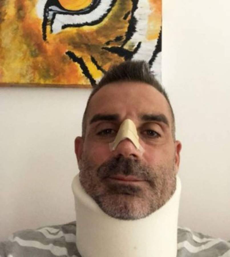 ¿Qué le dijo Cristiano Ronaldo a Sorrentino tras fracturarle la nariz en su debut en Italia?