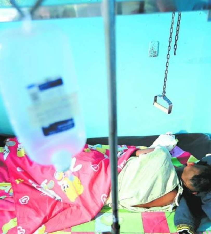 El 60 por ciento de los quemados por pólvora este 2016, son niños (Foto: El Heraldo Honduras / Noticias de Honduras)