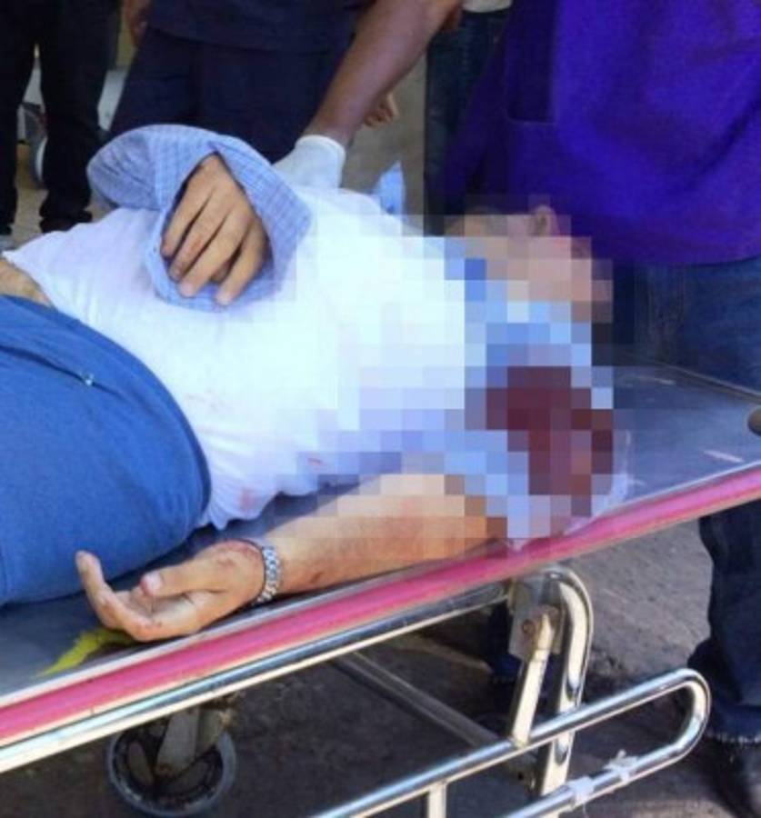 Dirigente del transporte de taxis habló durante 20 segundos con su victimario