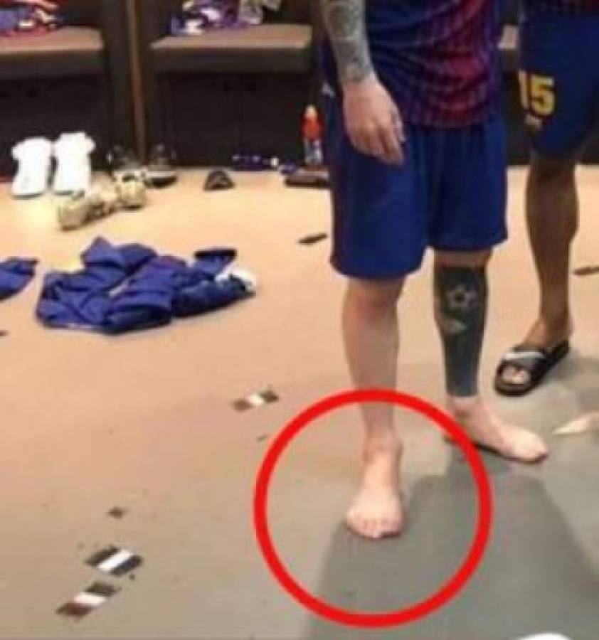 ¿Messi tiene seis dedos en el pie derecho? Imagen del argentino se vuelve viral