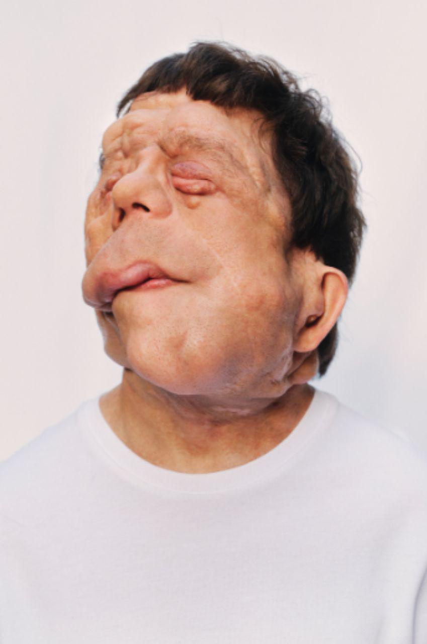 Adam Pearson, el actor con neurofibromatosis que brilló en los Oscar 2026