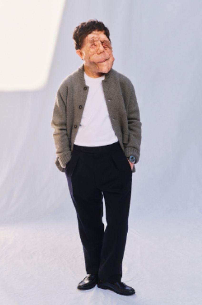 Adam Pearson, el actor con neurofibromatosis que brilló en los Oscar 2026