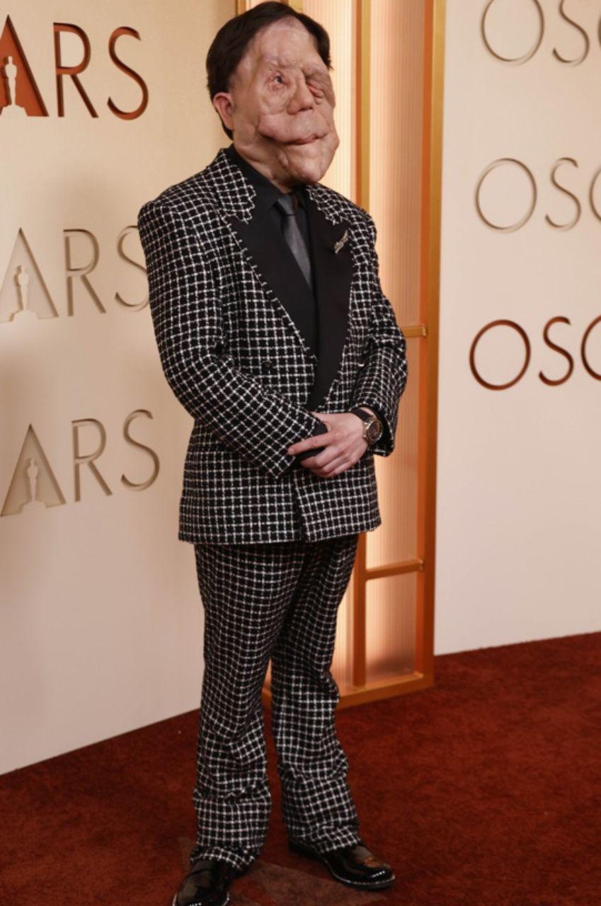 Adam Pearson, el actor con neurofibromatosis que brilló en los Oscar 2026