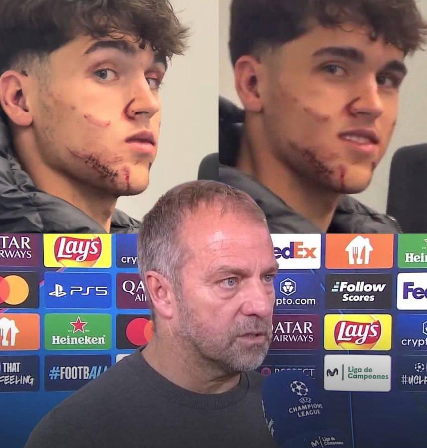 Fuertes imágenes: así quedó la cara de Pau Cubarsí tras recibir patada en Champions League Fuertes imágenes: así quedó la cara de Pau Cubarsí tras recibir patada en Champions League