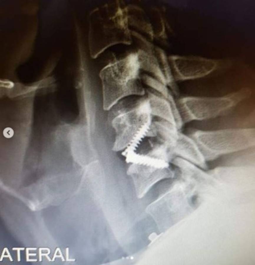 ¿Por qué fue operado de emergencia Arath de la Torre?